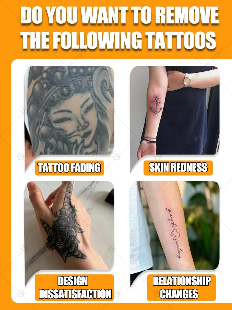 INKUVIA™ Permanent Tattoo Removing Serum - Remove Tattoos in 7 Days or Your Money Back!!