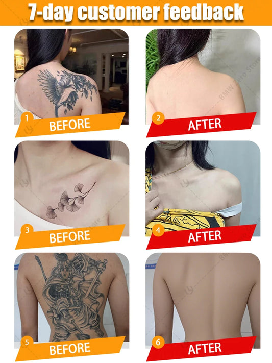 INKUVIA™ Permanent Tattoo Removing Serum - Remove Tattoos in 7 Days or Your Money Back!!
